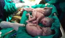Uttarakhand आंचल ने दिया एक साथ 3 बच्चों को जन्म, परिवार और डॉक्टरों में खुशी का माहौल