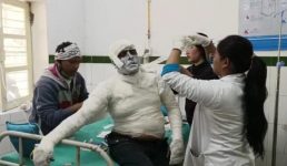 पिथौरागढ़ के धारचूला में गार्ड ने बैंक मैनेजर पर पेट्रोल डालकर आग लगा दी, गार्ड को किया गया गिरफ्तार